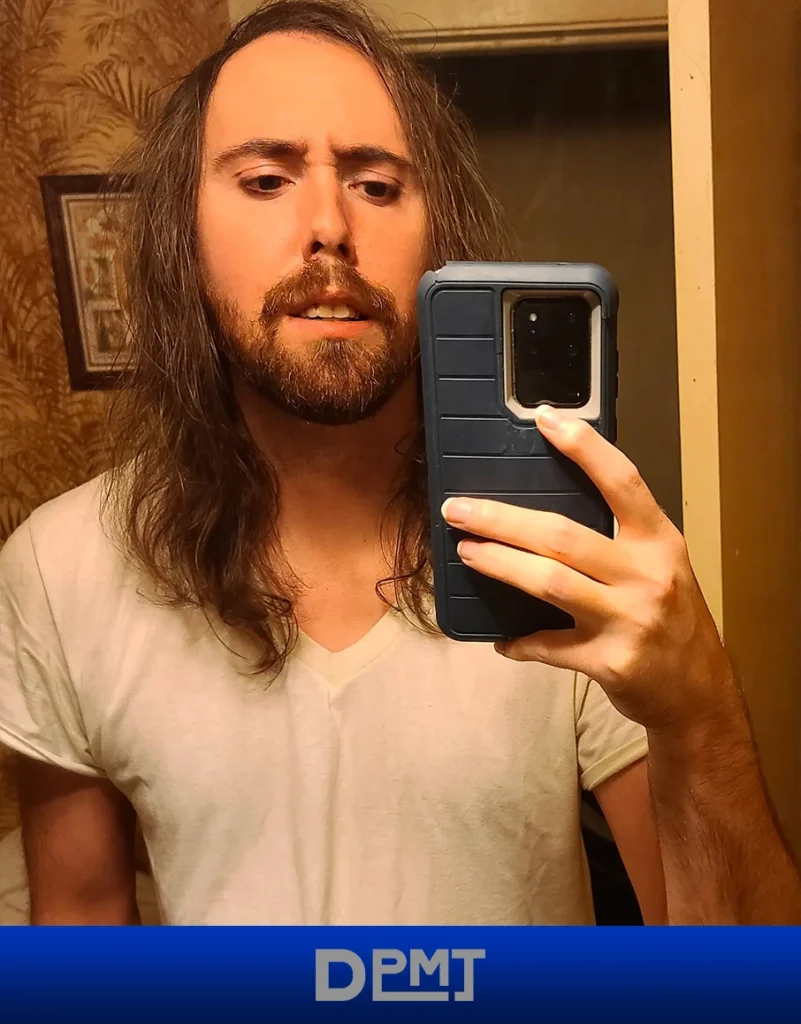 Asmongold Age _ DPMT